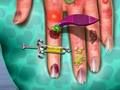 หมอผิวหนังมือ เกมออนไลน์