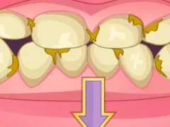 Bad Teeth Makeover เกมออนไลน์