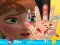 Anna hand doctor เกมออนไลน์