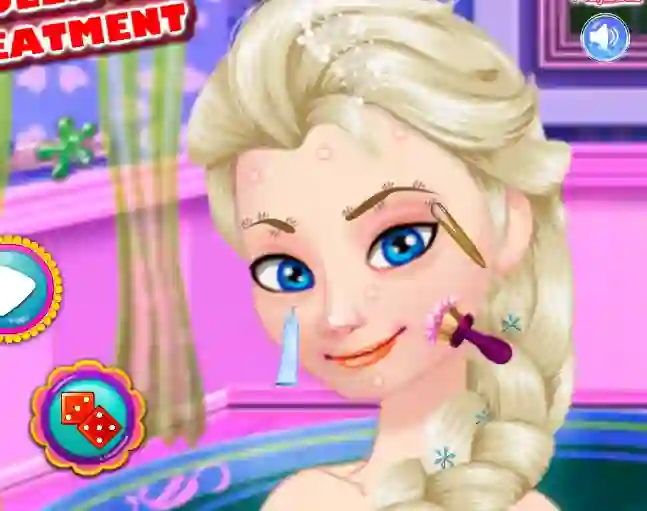 Ice Queen Acne Treatment เกมออนไลน์