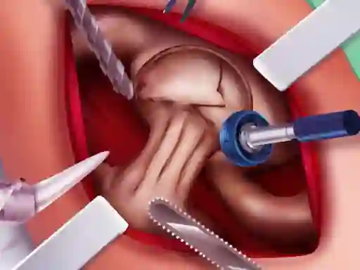 Princess Hips Surgery เกมออนไลน์