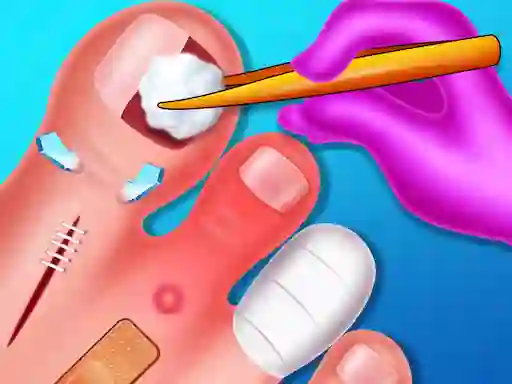 Funny Nail Doctor เกมออนไลน์