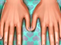 แพทย์ผิวหนัง: มือ  เกมออนไลน์