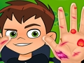 หมอมือ Ben10  เกมออนไลน์